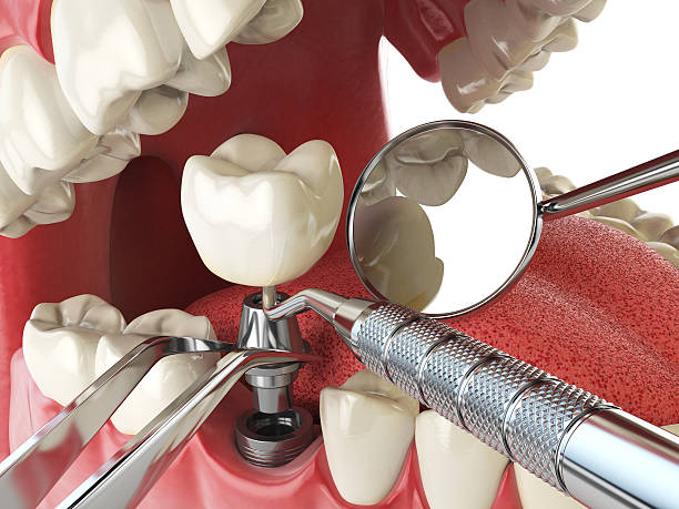 Best Walk-In Dentist Near Me  in Potomac, MD