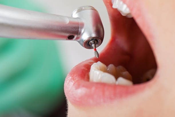 Best Emergency Dentist Open Today  in Potomac, MD